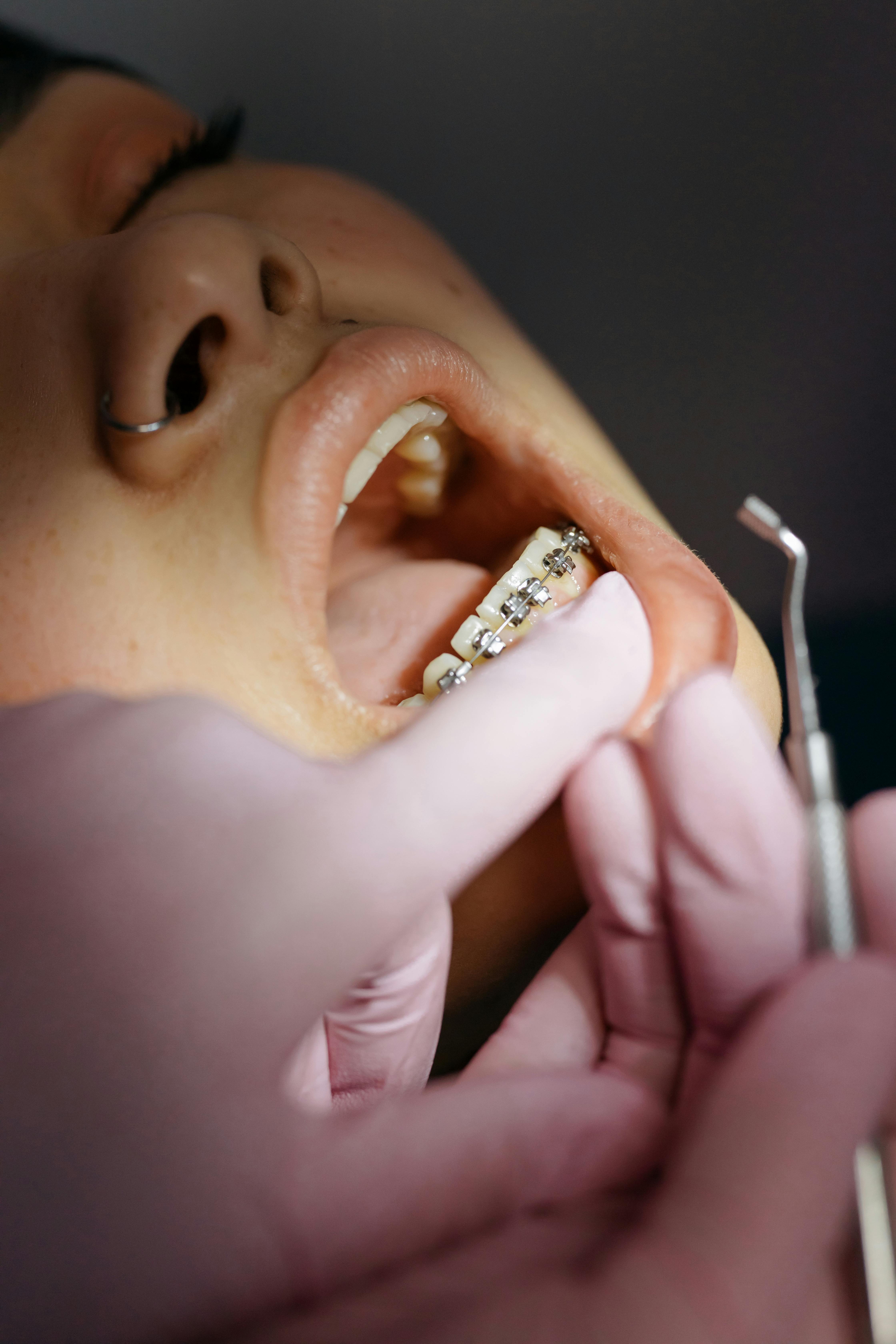 Orthodontics & Braces