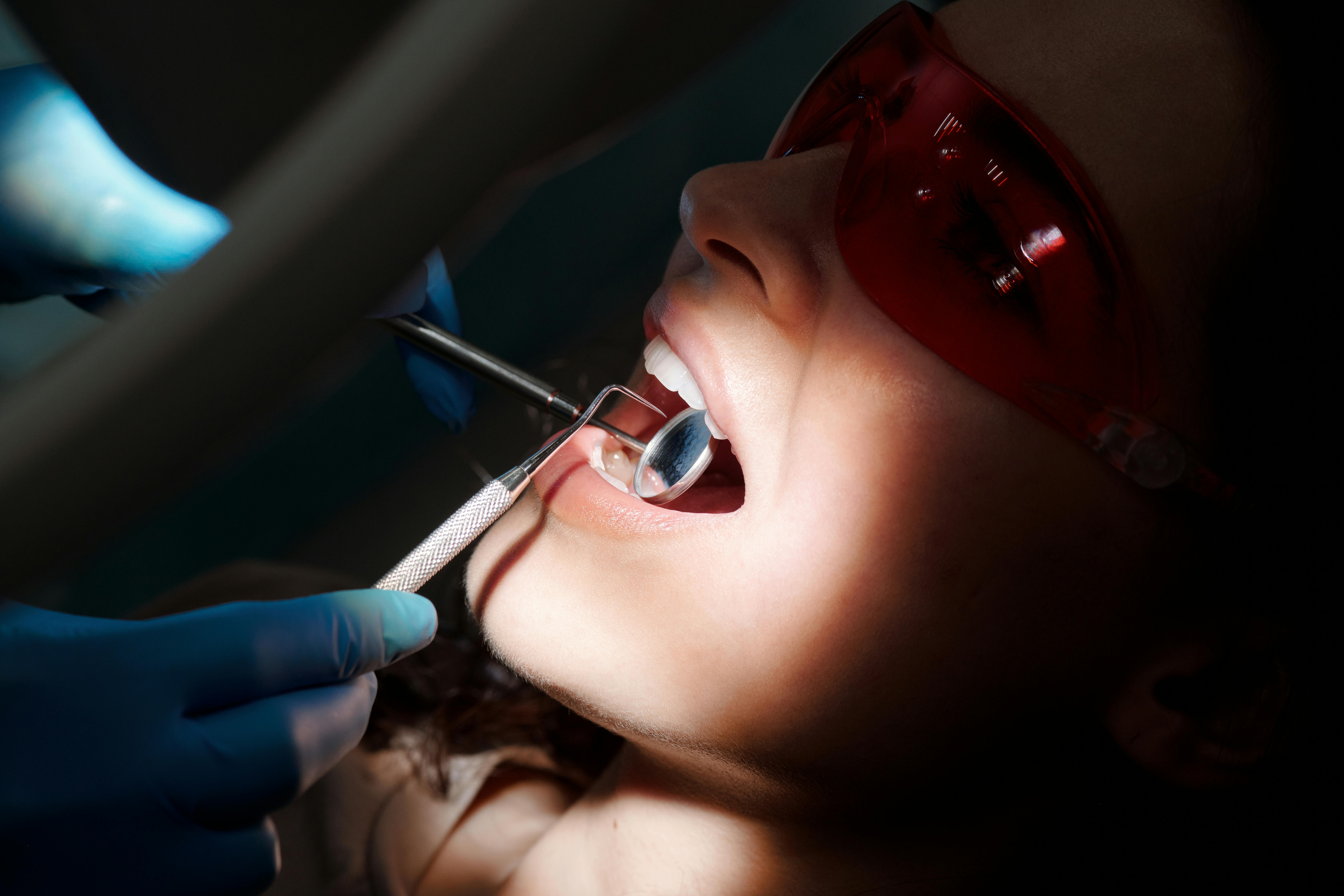 Dental Cleaning